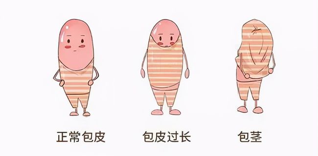 儿童包皮一定要切吗,齐齐哈尔附大男科乐动网站-乐动(中国)一站式服务官方网站
